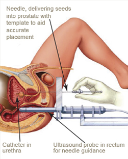 Information on testosterone